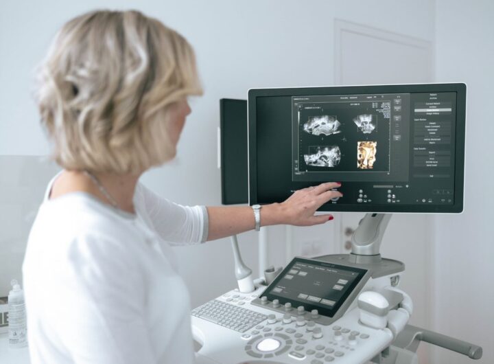 MUDr. Hana Visnova vedouci lekarka IVF CUBE s ultrazvukem
