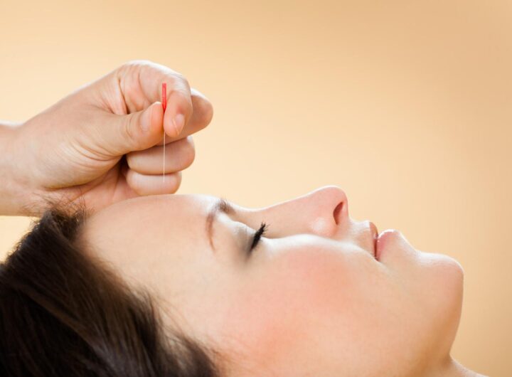 Tradiční čínská medicína