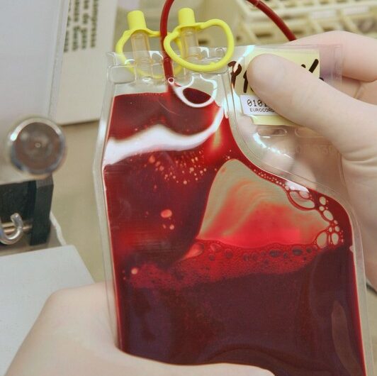 objem_krv zdroj Cord Blood Center