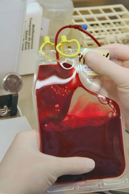 objem_krv zdroj Cord Blood Center
