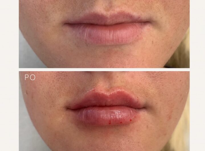 Krásné rty nejen na Valentýna