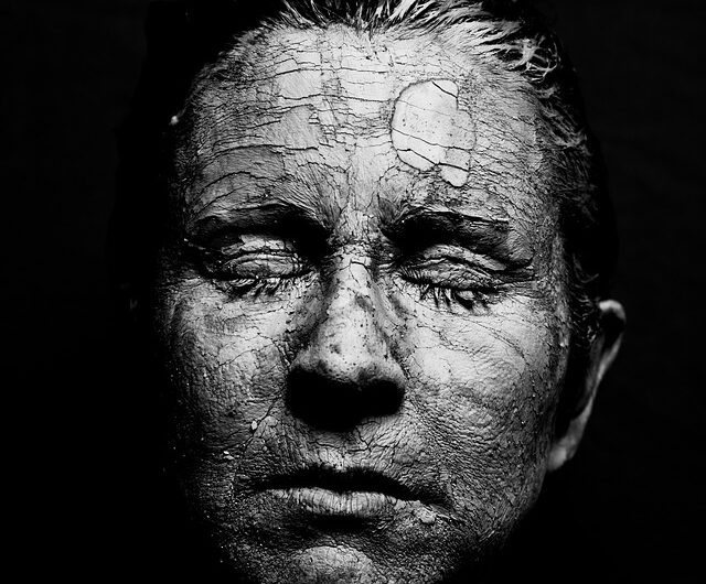 Využití AI v medicíně, Thomas Ruzicka , SkinVision, Dermatologické úspěchy, rakovina kůže, OZP, karcinom