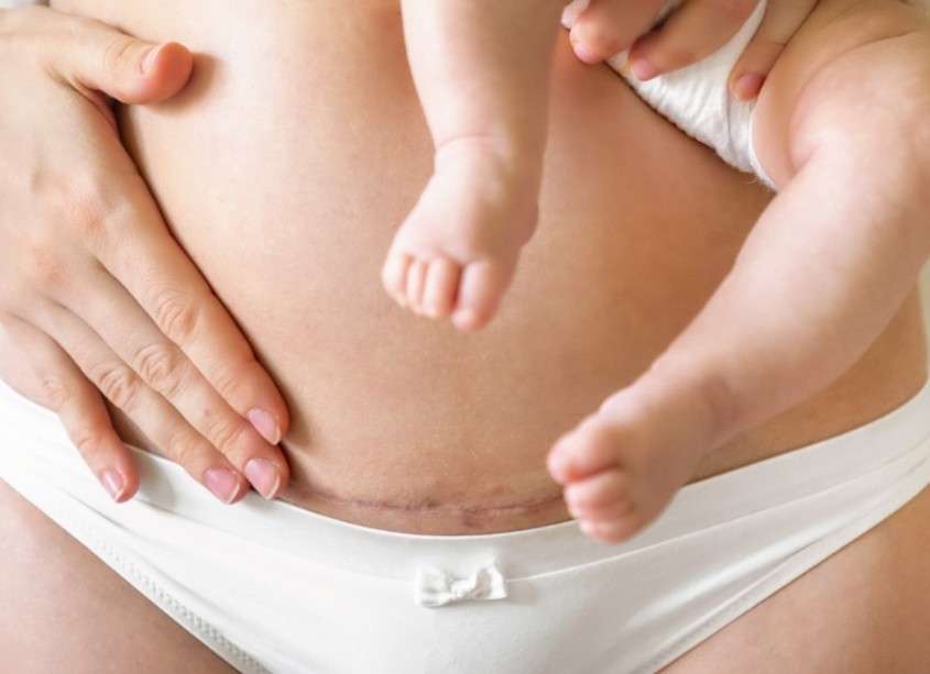 Poporodní stahovací pás