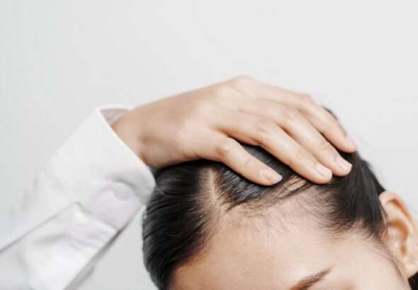 Zdravá pokožka hlavy , Revalid, kosmetika