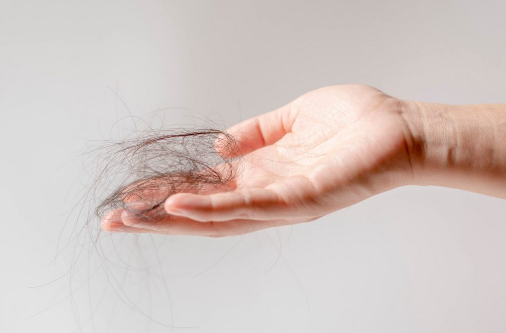 Ztráta vlasů, Řada Hair Loss od Revalid, vlasy