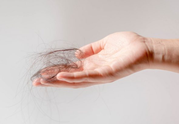 Ztráta vlasů, Řada Hair Loss od Revalid, vlasy