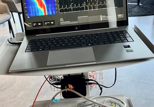EKG, Vysokofrekvenční EKG, zdraví,
