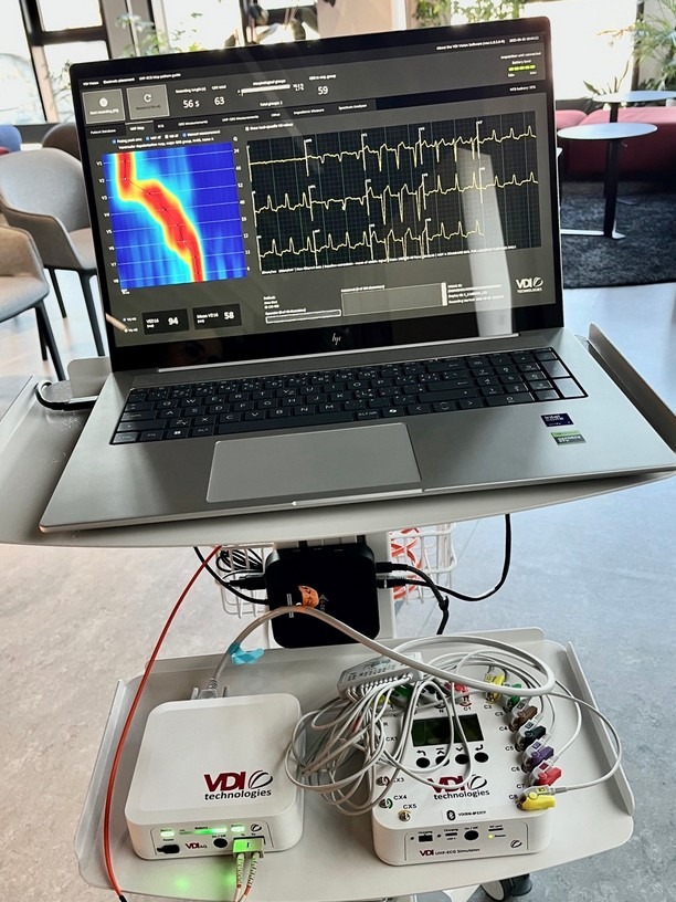 EKG, Vysokofrekvenční EKG, zdraví,