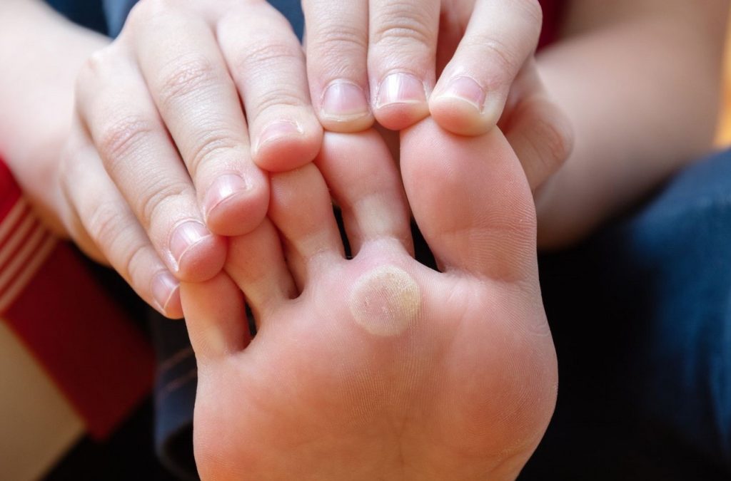 měsíc zdravé kůže, National Healthy Skin Month, zdraví