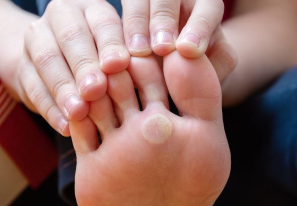 měsíc zdravé kůže, National Healthy Skin Month, zdraví