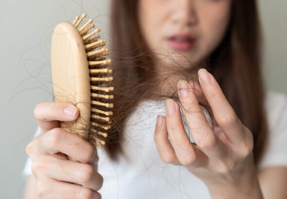 Vlasy, Revalid, Revalid Hair Complex, MUDr. Gabriela Kičmerová,