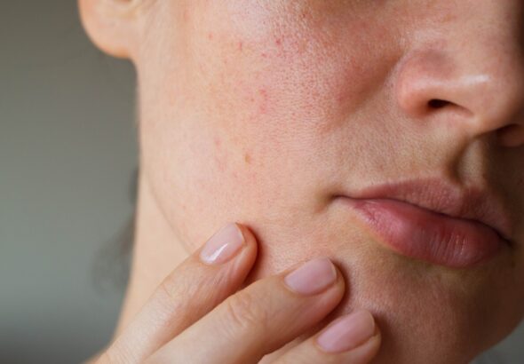 Mikrozáněty, zdraví,