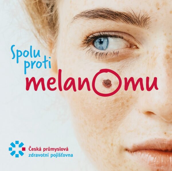 Melanom, vyšetří znaménka
