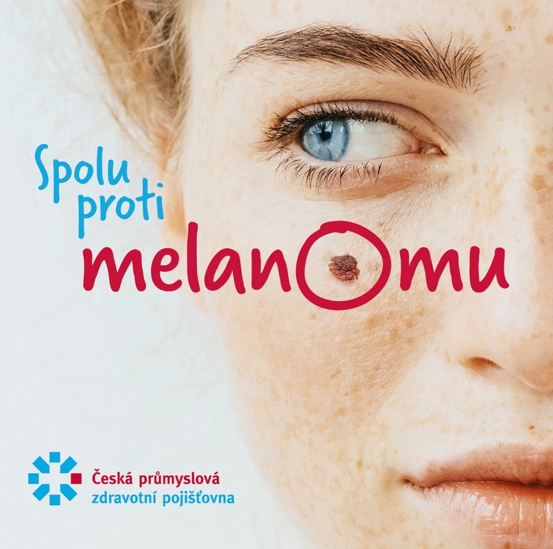 Melanom, vyšetří znaménka