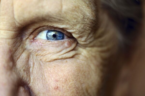Den seniorů, Laser LenSx, Oční klinika NeoVize Brno